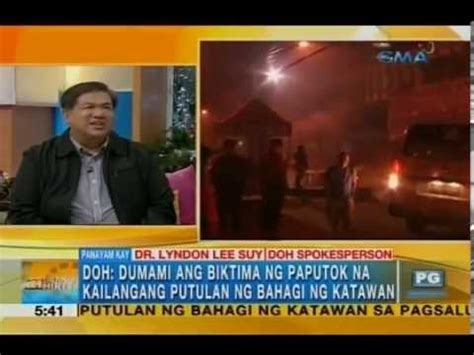 DOH Spokesman 38 Less Firecracker Injuries In 2015 Unang Hirit