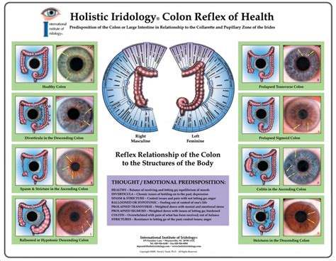 Iridology Diagnosis Chart Here S A Quick Way To Know Iriscope