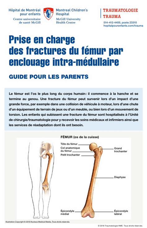 Pdf Prise En Charge Des Fractures Du F Mur Par S La Chirurgie