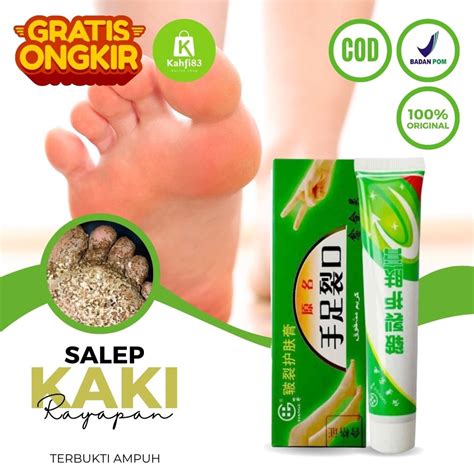 Jual Obat Kaki Pecah Pecah Dan Kering Dan Kasar Obat Kaki Rayapan Dan