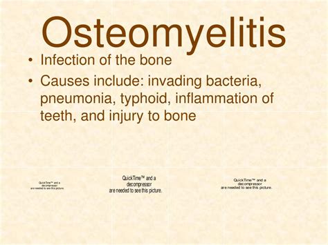 PPT - Skeletal System Disorders PowerPoint Presentation, free download - ID:1402455