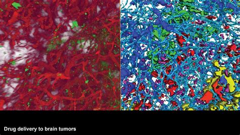 Colloids and Biological Interfaces