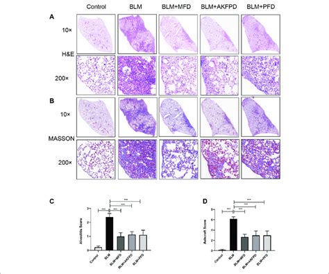 Mefunidone Ameliorated Bleomycin Induced Pulmonary Fibrosis