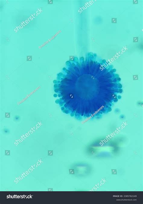 Aspergillus Fungus Fruiting Body Vesical Conidia Stock Photo 2385762149