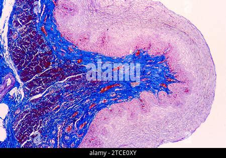 Human Esophagus Or Oesophagus Showing Squamous Epithelium Stratified