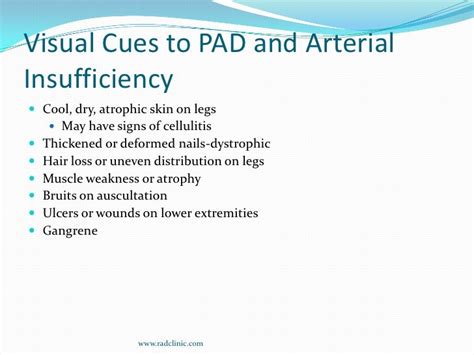 Peripheral Arterial Disease