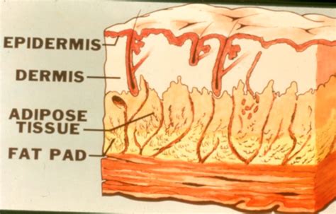 Burns And Common Integumentary Disorders Flashcards Quizlet