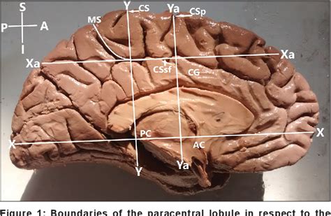 Figure 1 From Morphology And Morphometry Of Human Paracentral Lobule