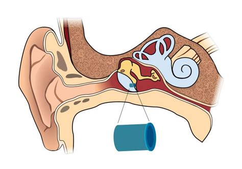 Ear Tubes Mississippi Ear Nose And Throat Surgical Associates