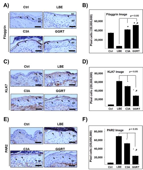 The Effect Of Ggrt On The Expression Of Skin Barrier Related Proteins