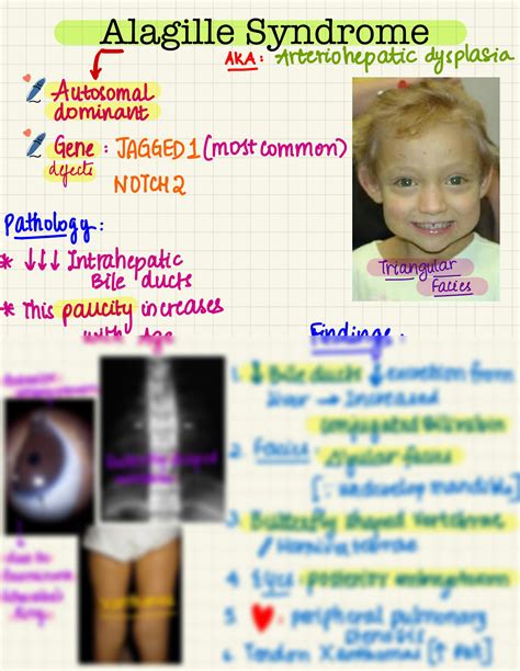 Solution Alagille Syndrome Studypool