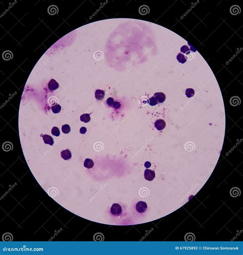 Mesothelial Cells Stock Photo Image Of Marrow Lymphocyte 67925892