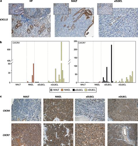 Cxcl Expression In H Pylori Associated Gastritis Gastric Malt