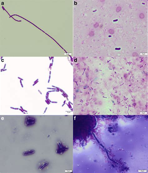 Whole Genome Sequencing And Identification Of Bacillus Endophyticus And