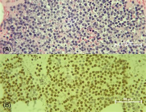 Bone Marrow A Histopathology—40× Magnification Hematoxylin And