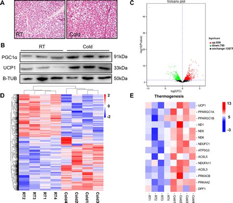 Cold Exposure Promotes Bat Thermogenesis Of Perirenal Bat In Newborn