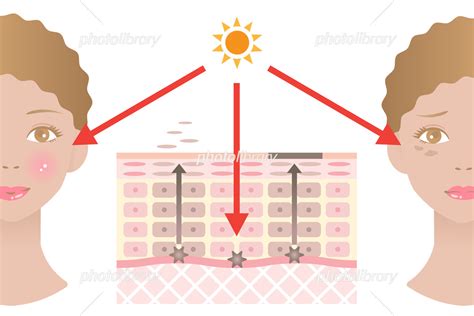 しみ 肌の断面図と女性 イラスト素材 6580936 フォトライブラリー Photolibrary