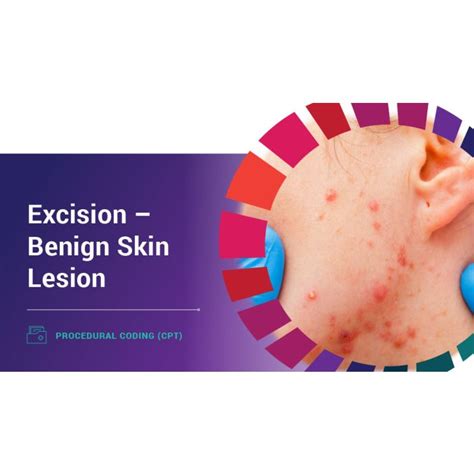 Procedural Coding Cpt Excision Benign Skin Lesion