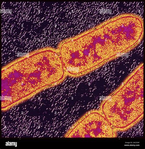 Mycobacterium tuberculosis. Transmission electron micrograph (TEM) of Mycobacterium tuberculosis ...