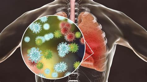 Coronavirus Un enemigo increíblemente astuto por qué el virus que