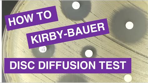 Disc Diffusion Kirby Bauer Antimicrobial Susceptibility Testing YouTube