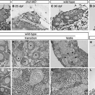 PDF Germ Line Control Of Female Sex Determination In Zebrafish