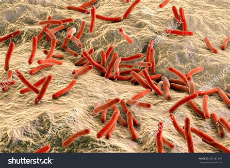 390 Mycobacterium Leprae Images, Stock Photos & Vectors | Shutterstock