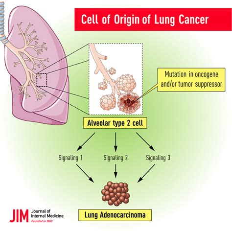 Types Of Non Small Cell Lung Cancer Causes Treatment And 41 Off