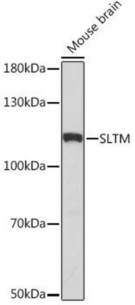 Anti Sltm 抗体 Cab18493 Assay Genie