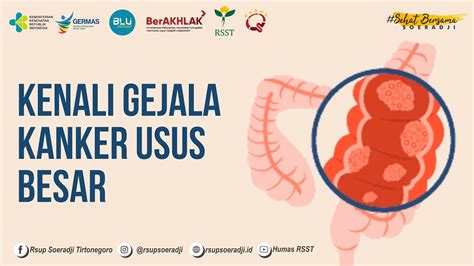 Kenali Gejala Kanker Usus Besar Rsup Dr Soeradji Tirtonegoro