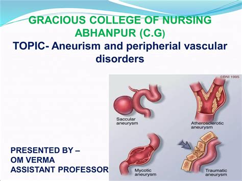 Aneurism And Peripherial Vascular Disease Ppt