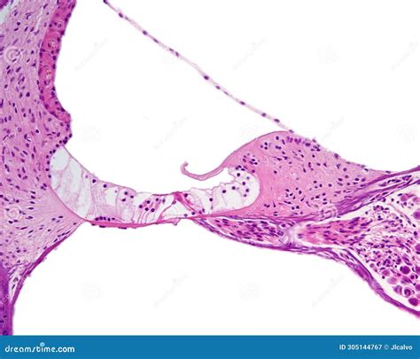 Organ Of Corti Stock Image Image Of Aural Organ Otology