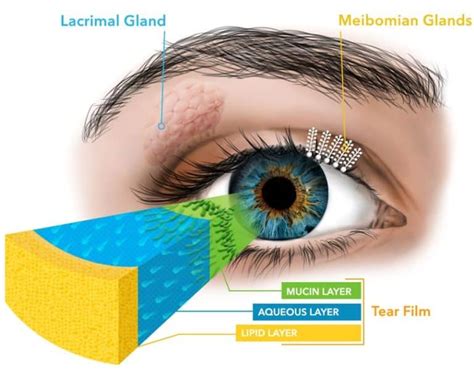 Top 21 Causes And Treatments For Dry Eye Syndrome A Helpful Illustrated Guide Ask Eye Doc