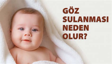 Bebeklerde Göz Sulanması Neden Olur Ve Nasıl Tedavi Edilir