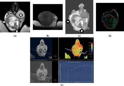 Figure 4 From An Overview Of The Role Of Multiparametric Mri In The