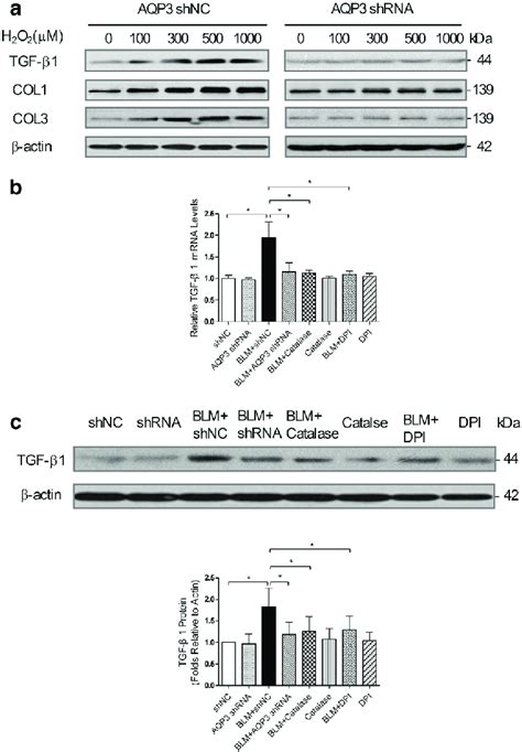 Silencing Aqp Can Reduce Blm Induced Tgf B Expression By Decreasing