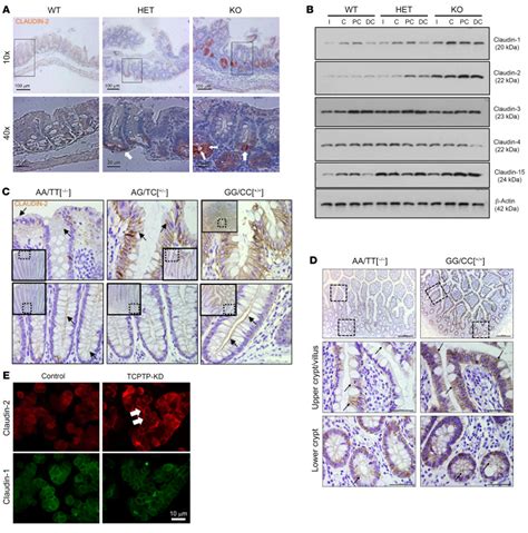 T Cell Protein Tyrosine Phosphatase Protects Intestinal Barrier