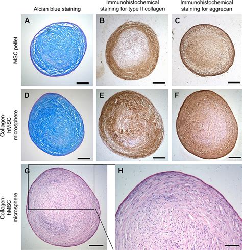 In Vitro Chondrogenic Differentiation Of Human Mesenchymal Stem Cells