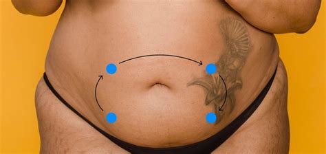 14 9 Abdomen Auscultation Nursing Physical Assessment