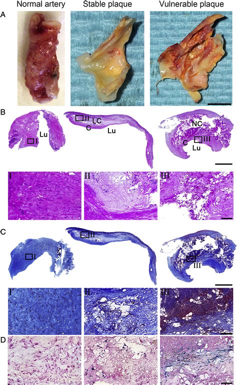 Towards Non Invasive Imaging Of Vulnerable Atherosclerotic Plaques By Targeting Co Stimulatory