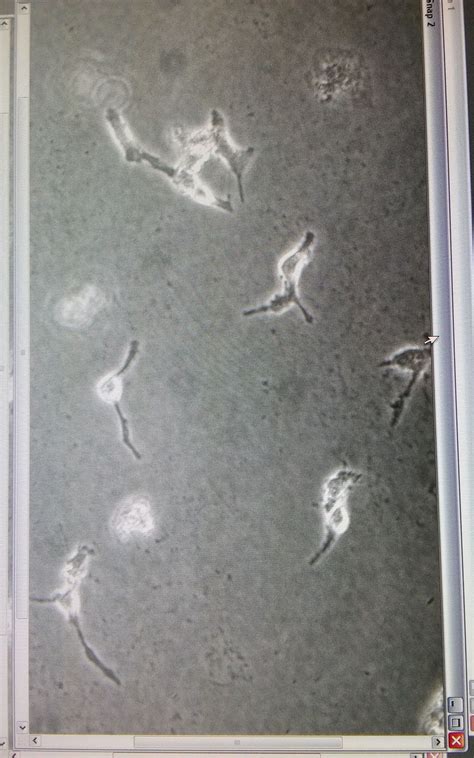 Are these bacteria/yeast contamination? | ResearchGate