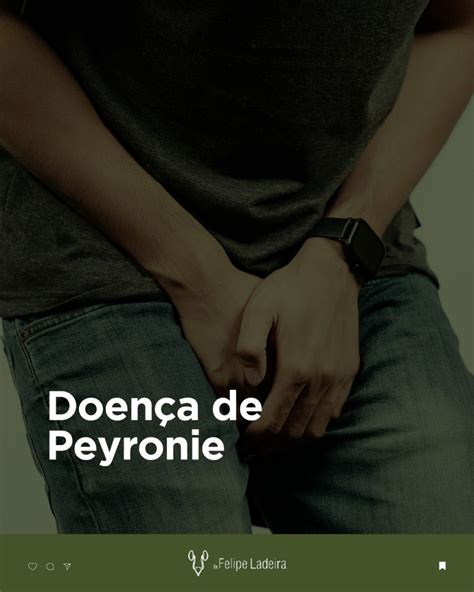 Doença De Peyronie Saiba Mais Dr Felipe Ladeira