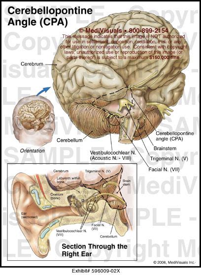 Cerebellopontine Angle Anatomy Ppt