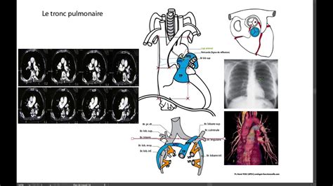 A Art Res Pulmonaires Youtube