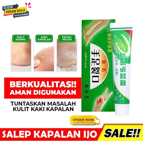 Jual Paling Ampuh Salep Krim Mengatasi Tumit Kaki Tangan Kering