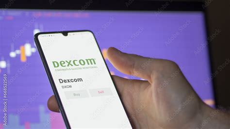 Logo Of Dexcom On The Screen Of An Exchange Dexcom Price Stocks DXCM