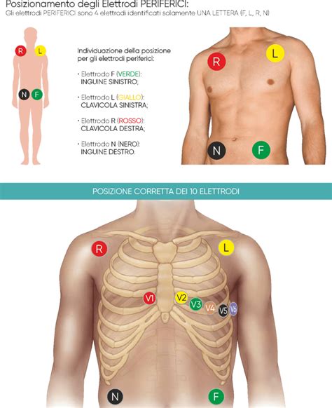 ECG Abintrax We Tech Care