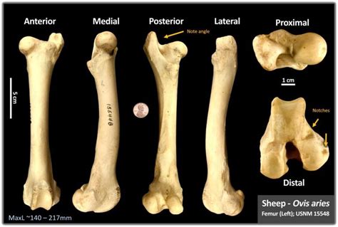 Bones Osteoid Bone Identification