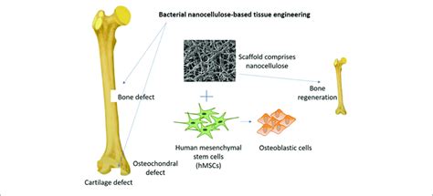 Bone Regeneration Concept Conducted By The Synergistic Effect Of