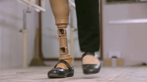 prosthesis | Definition, Types, & Facts | Britannica